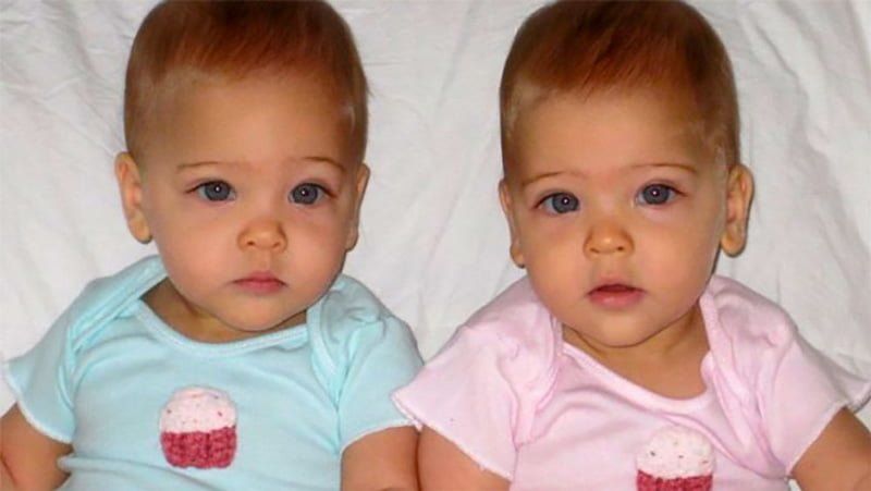 8 Sene Önce Dünya’nın En Güzel İkizleriydi Bir De Şimdi Görün